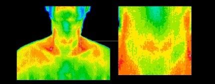 las vegas thermography|What the Doctors Are Saying – Las Vegas Thermography.